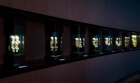 Prenatal Development Exhibit, Museum of Science and Industry, Chicago IL, undated/msichicago.com