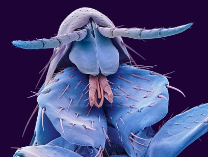 Human flea (Pulex irritans) / Science Photo Library, Getty Images, COSMOS / Click for more.