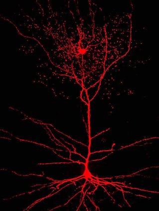 Rosehip neuron (top), connecting pyramidal cell (bottom) / Tamas Lab, U of Szeged, NPR / Click for more.